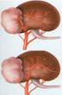 Nierkanker: verwijderen van de nier (nefrectomie)