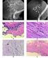 Molecular changes in hepatobiliary function and injury after human liver transplantation Geuken, Wirtje