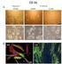 Morphological aspects of recurrent prostate cancer Rybalov, Maxim