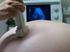 Echo onderzoek tijdens de zwangerschap De termijnecho, combinatietest en de 20 weken echo