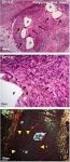 The immune response to alfab-crystallin: self, non-self and phosphorylation van Stipdonk, M.J.B.