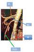 Covered stents in aortoiliac occlusive disease Grimme, Frederike