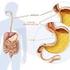 Gastro-oesofageale refluxziekte: pathofysiologie, diagnostiek en medicamenteuze therapie