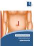 abdominale heelkunde informatiebrochure Laparotomie