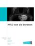 MRI van de borsten. T +32(0) F +32(0) Campus Sint-Jan Schiepse bos 6. B 3600 Genk