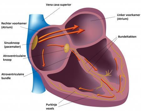 Herstel op de afdeling Gemiddeld 5 tot 6 dagen Ritmebewaking Atriale vs ventriculaire tijdelijke pacemaker Mobiliseren