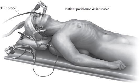 Bron: Marin Cuartas et al.