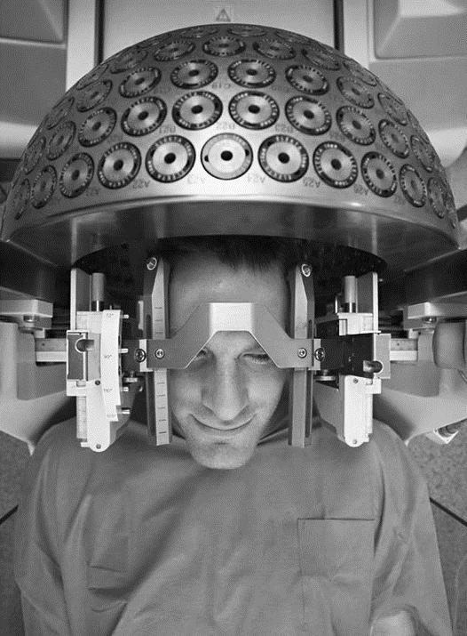 Gamma-chirurgie Gamma-chirurgie ( gamma knife radiosurger ) figuur 1 wordt toegepast voor de behandeling van tumoren die kleiner zijn dan ongeveer 3 cm en in een gebied van de hersenen liggen dat
