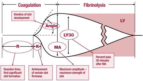 GLOBAL HAEMOSTASIS ASSAYS