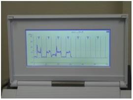 LOKAAL ONDERZOEK BEKKENBODEM Myofeedback: -Vaginaal of