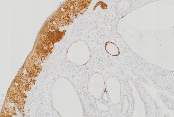 Immunohistochemie 2016/2.