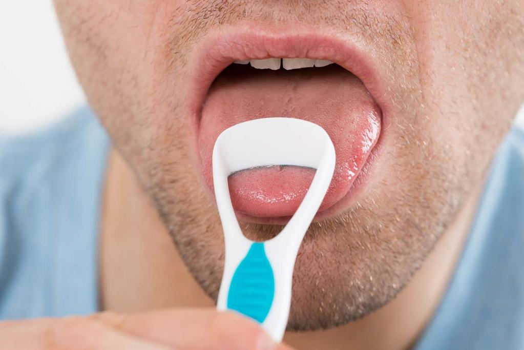 Poetsen, hoe doe ik dat? U kunt een tongschraper gebruiken wanneer er op de tong een beslag zit (wit, geel of bruin). Tongbeslag kan immers leiden tot een slechte adem.