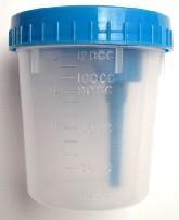 Urine: bacteriologische kweek, pneumococcen antigeentest, legionella antigeentest, schimmelkweek, virus PCR Aandachtspunt: Het boorzuur in de microbiologie buis kan de zuurgraad van de urine