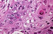 histologies and clinical characteristics that are