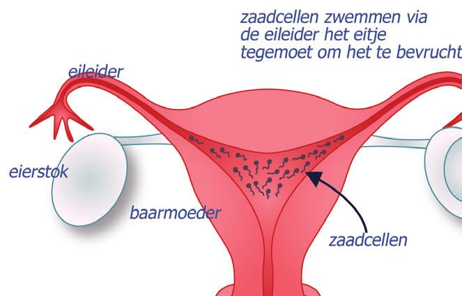 De gynaecoloog kan de sterilisatie op twee