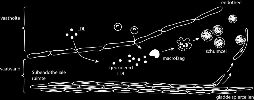 1,40 Figuur 2B: Laboratoriumclassificatie van een aantal aandoeningen bij volwassenen waarbij de cholesterol- en/of triglyceridenconcentraties in het bloed afwijkend zijn geïsoleerde