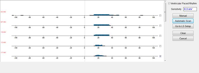 Als de automatische scans voltooid zijn, verschijnen alle verzamelden histogrammen in het lokale voel-scanscherm. De gebruiker kan vervolgens de meest geschikte voeldrempelwaarde kiezen.