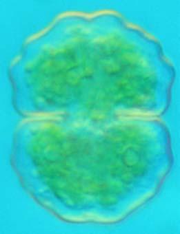 Onderzoek van fytoplankton en epifytische diatomeeën in