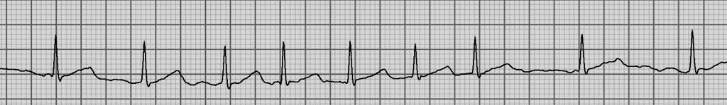 Wat is de frequentie? 1. 105 2. 95 3. 85 4. 75 5.