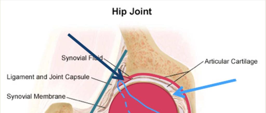 Labrum