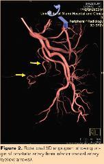 American Urological Association (AUA), Guidelines on the management of benign prostatic hyperplasia, Short-, medium-, and long-term outcome of