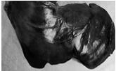 5 Anatomie: - Grootste inwendige orgaan - Gewicht van 1200 1500 g -rechtsboven