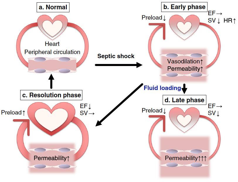 Normaal Vroege fase EF SV, HF Hart Perifere circulatie Septische shock Vasodilatatie Permeabiliteit