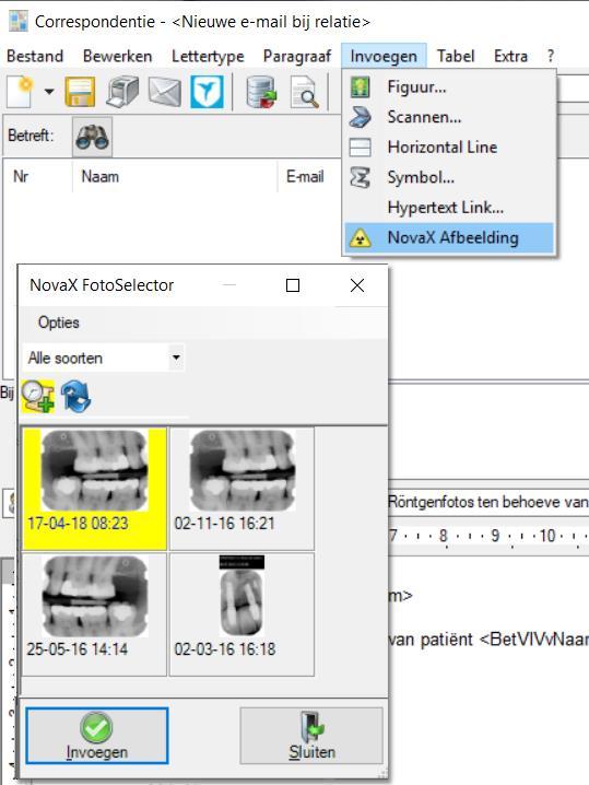 Röntgenfoto s via Zivver verzenden Wilt u uw NovaX foto s via Zivver versturen, dan kan dit rechtstreeks vanuit NovaX of via de Correspondentie.