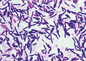 Practicum 6 Zonder microscoop zie je ze niet, maar ze zijn overal: bacteriën.