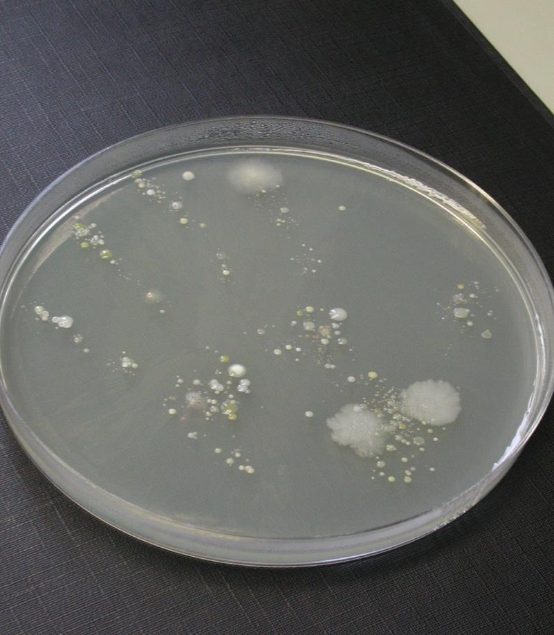11 Persoonlijke Hygiëne is belangrijk! Op deze foto: Kolonies van micro-organismen op een vast medium.