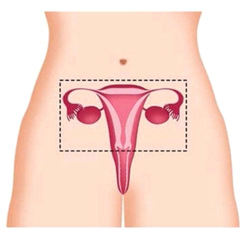 Wel of niet verwijderen van de baarmoederhals Bij een baarmoederverwijdering wordt de baarmoederhals in principe ook altijd verwijderd.