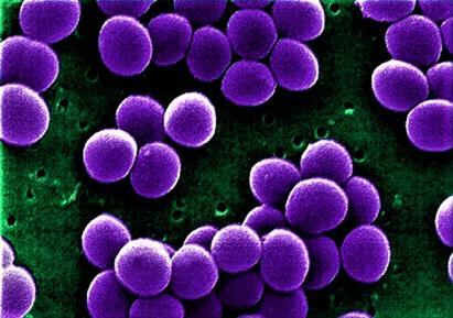 Staphylococcus aureus Wijziging PBP2a verminderde activiteit van beta-lactam antibiotica