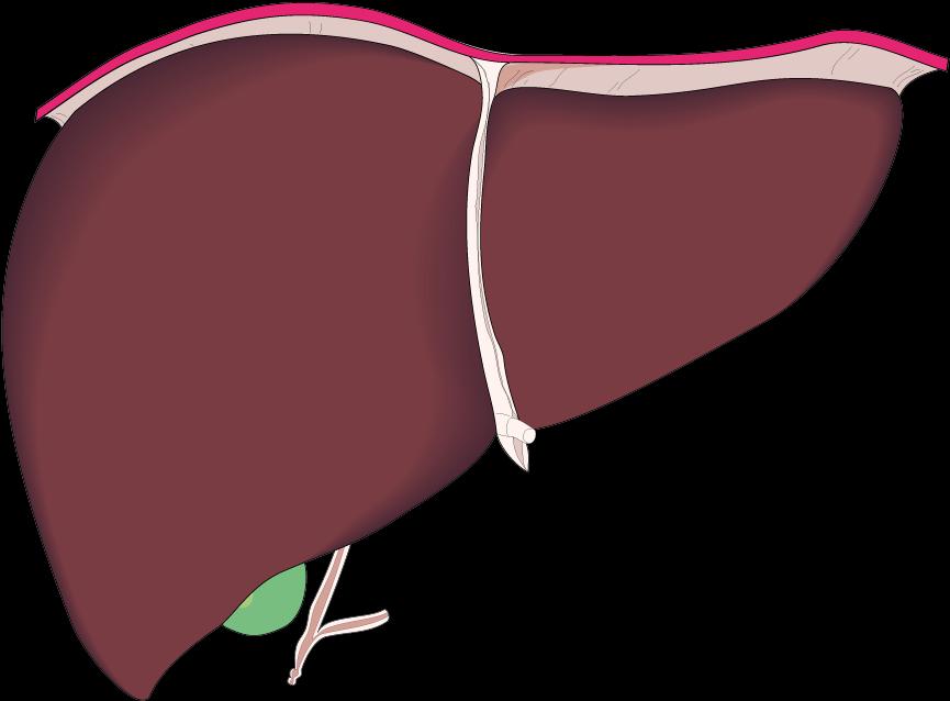 Vit. K antagonisten (coumarines) acenocoumarol(sintrommitis),