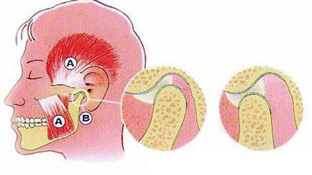 A A B C D A. kauwspieren B. kaakgewricht C. gesloten mond D. geopende mond KAUWSPIEREN We gebruiken de kauwspieren voor de bewegingen van de kaak. Bijvoorbeeld bij het kauwen, slikken of praten.