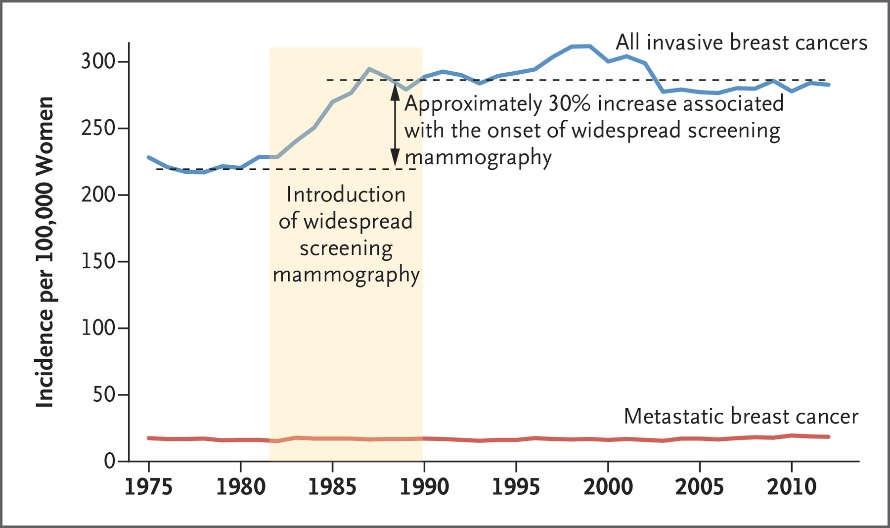 Meer borstkanker door screening Bij de start van screening stijgt het aantal gevallen altijd: aantal symptomatische kankers blijft gelijk + asymptomatische kankers die door de