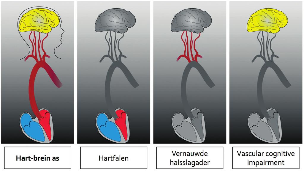 Afbeelding 3. Schematische weergave van de hart-brein as. Credentials: Gerrit Kracht, medisch fotograaf / grafisch vormgever, Afdeling Radiologie LUMC.