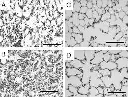 In vivo studie: (ratten, geïnfecteerd met E-coli, >48 uur) Statische compliantie was significant