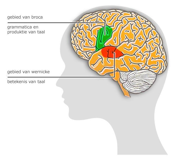 Vaak beschadiging links in de hersenen Hersengebied voor taal begrijpen