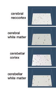 Normal cerebral and cerebellar tissue 3D reconstruction of the cerebral neocortex, cerebral white matter, cerebellar cortex, and cerebellar white matter revealed a regular vascular pattern with