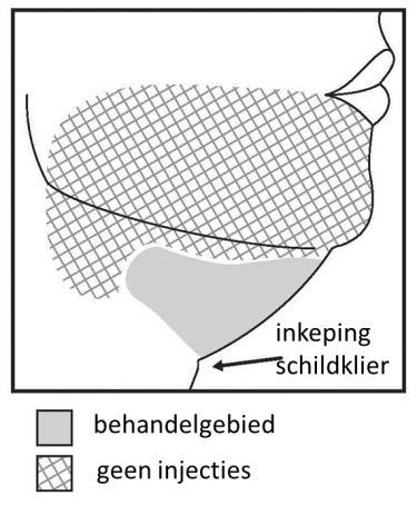 Injecteer Belkyra alleen binnen het doelgebied voor de behandeling van submentaal vet (zie afbeelding 1 en 3). Afbeelding 1.
