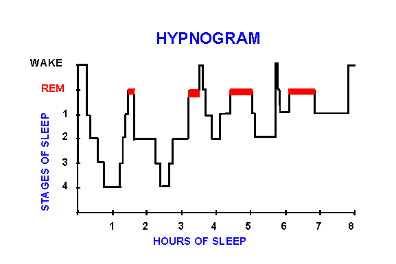 Figuur 2. Onderstaand hypnogram geeft het grafisch verloop van de slaap weer van een gezonde man.