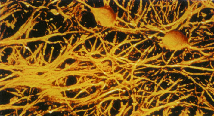 De uitgaande draad, waarvan er maar één is, heet axon. De dendrieten ontvangen de signalen van buurcellen en geven die door naar het cellichaam.