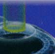 LASIK (zie hierboven onder 1c), maar kunnen ook lensjes van weefsel uit het binnenste b van het hoornvliesweefsel gesneden worden, waarmee ook