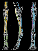 Zo, dat waren de puncties van de synoviale holten van het voorbeen Neuroanatomie... vragen?...ook voor het achterbeen écht nodig, dus... N.tibialis Neuroanatomie achterbeen Essentieel anders dan in het voorbeen N.