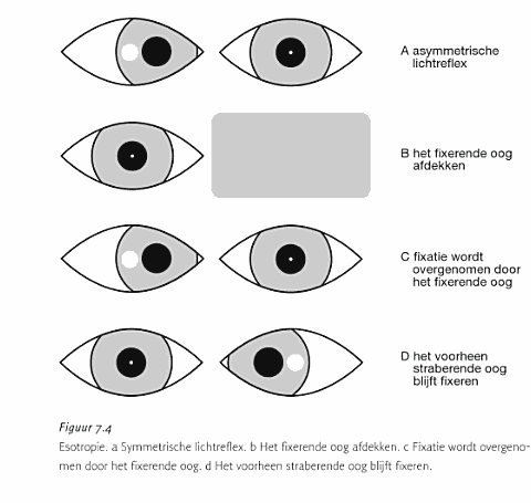 Bij asymmetrische reflexbeeldjes wordt het fixerende oog kortdurend afgedekt. Het niet-afgedekte oog zal een herstelbeweging maken, van nasaal naar temporaal om het lichtje te fixeren.