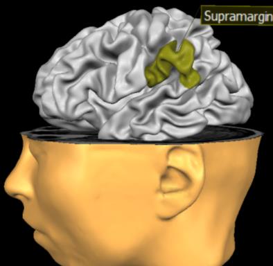 parietalis superior(2) : gyrus angularis (3) en gyrus supramarginalis
