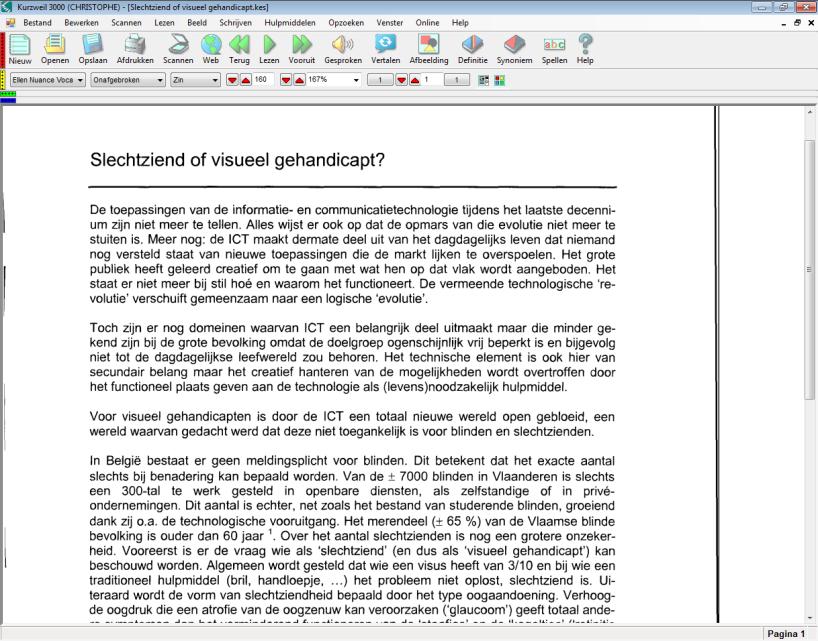Kurzweil 3000 Fiche 2: Scannen met Kurzweil 3000 Fiche 2: Scannen met Kurzweil 3000 Hoe kan ik teksten scannen met Kurzweil 3000? 5. Welke voordelen biedt deze werkwijze? Je kunt zelfstandig scannen.