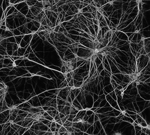 neurtotransmitters (chemi sche stofjes) zorgen ervoor dat boodschappen via neuronenverbindingen van het ene hersengebied naar het andere worden verzonden Neuronenverbindingen Johns gedachte dat hij