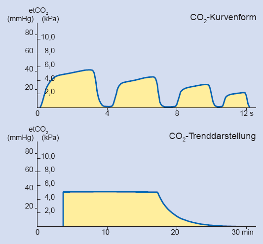 D: Punt van meeting van het eindexpiratoire CO 2 Als voorbeelden staan hieronder diagrammen met mogelijke oorzaken. Boven het golfvorm display, beneden de trendgrafiek.