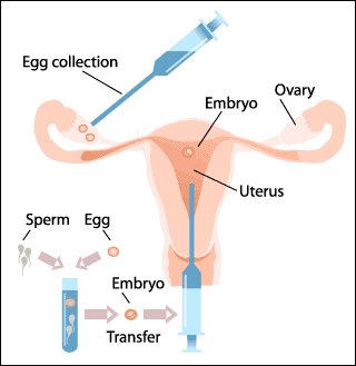 spermadonor (2)